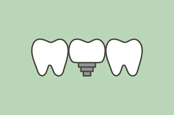 Implante dental, dientes cambian nueva raíz — Archivo Imágenes Vectoriales