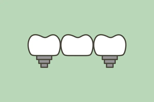 Puente dental, dientes cambian nueva raíz — Vector de stock