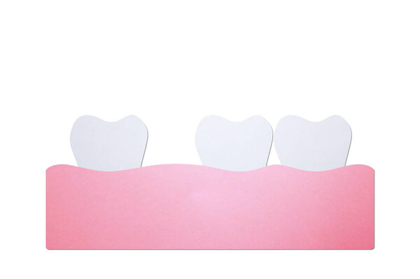 spacing teeth (diastema), dental problem