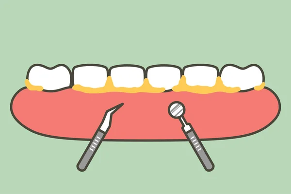 Změna velikosti, odstranění zubního plaku pro čištění zubů — Stockový vektor