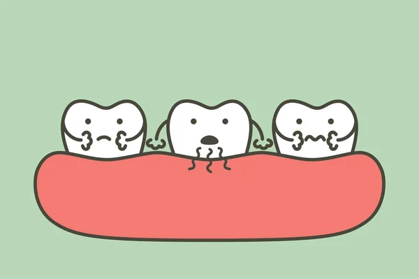 Dent est halitose ou mauvaise haleine — Image vectorielle