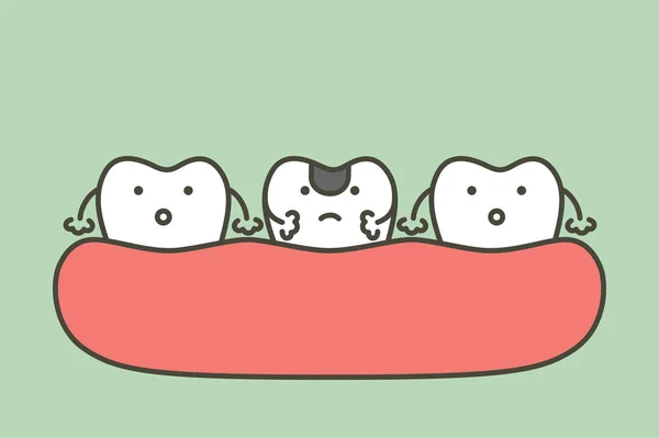 Förfall tand eller karies — Stock vektor