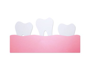 Gevşek dişler ya da eksik dişler, dişler sakızdan dökülüyor - dişçi karikatür kağıdı tasarım için şirin bir karakter.