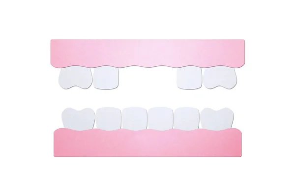 Dente Modelo Dentes Ausentes Papel Desenho Animado Dental Corte Estilo — Fotografia de Stock