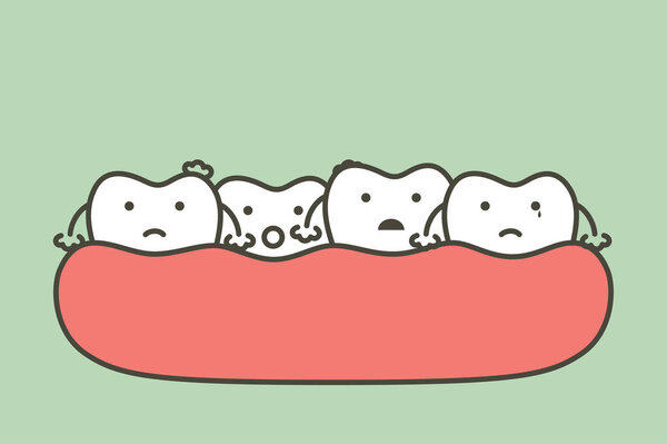 crowding teeth (malocclusion), dental problem - tooth cartoon vector flat style cute character for design