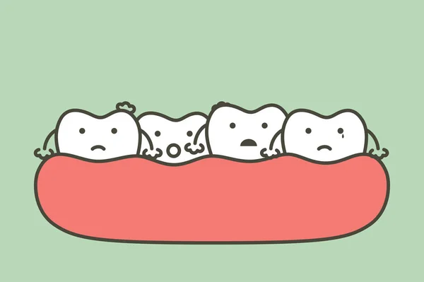 混雑歯 マロクルージョン 歯の問題 デザインのための歯漫画ベクトルフラットスタイルかわいい文字 — ストックベクタ