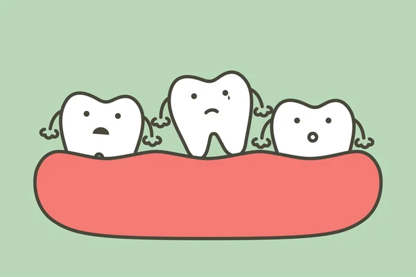 Diente Suelto Dientes Faltantes Diente Cae Encía Vector Dibujos Animados — Archivo Imágenes Vectoriales