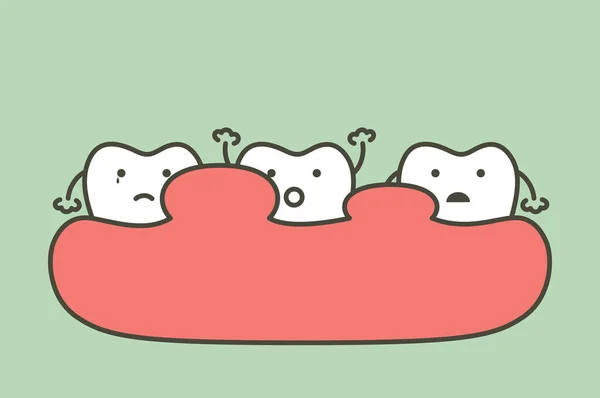 Ohälsosamma Tänder Eftersom Tandköttsinflammation Eller Tandköttsproblem Med Böld Tuggummi Svullen — Stock vektor