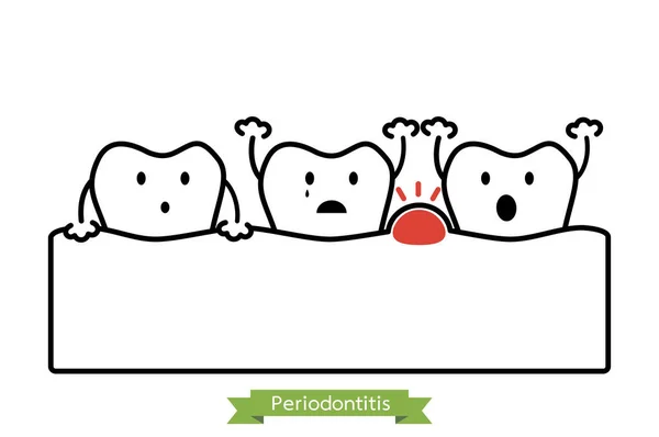 Parodontitis Tandvlees Ziekte Met Zwellingen Tandvlees Tand Gezwollen Als Gevolg — Stockvector