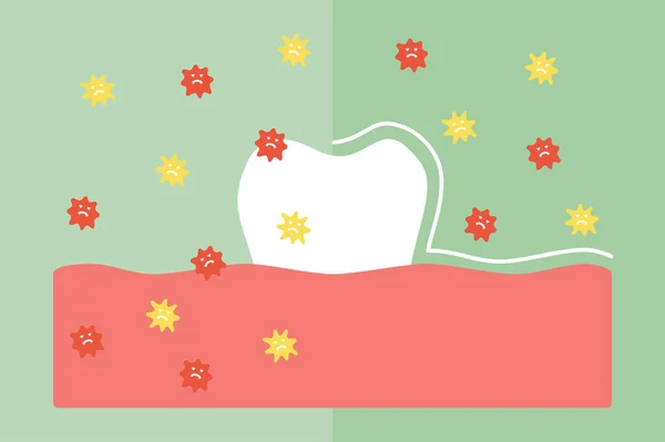 Comparer Les Dents Entre Par Protection Non Par Protection Bactéries — Image vectorielle