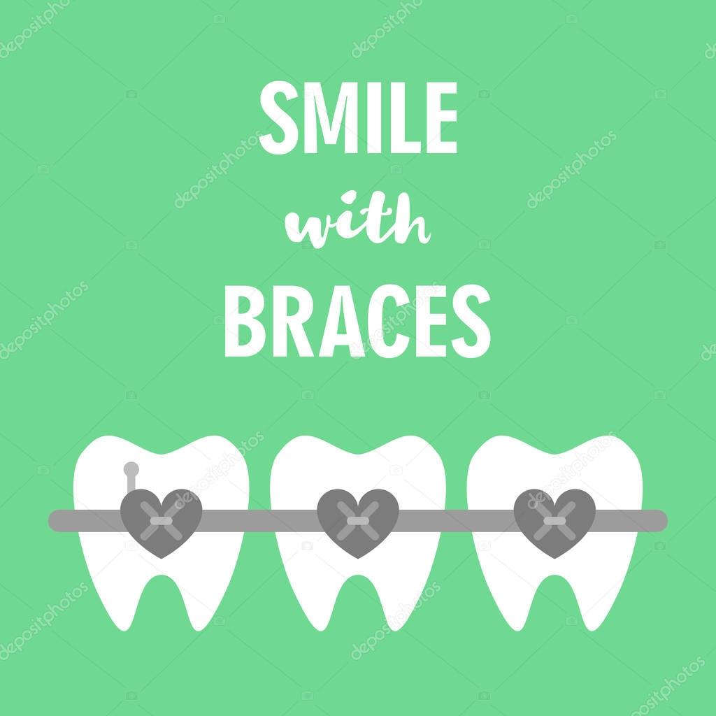 Smile with braces on teeth vector illustration. Dental Braces. Heart shape braces. Dental healthcare