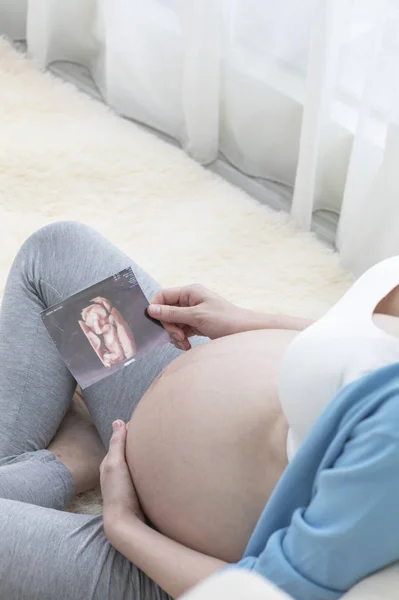 年轻孕妇正在看婴儿的声像图 — 图库照片