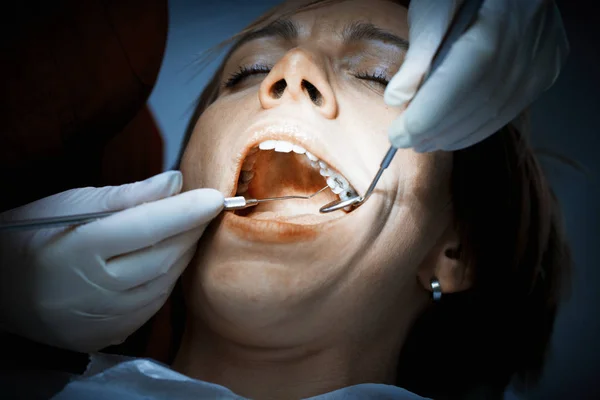 Zahnarzt untersucht Zähne eines Patienten vor einer oralen Operation an der de — Stockfoto