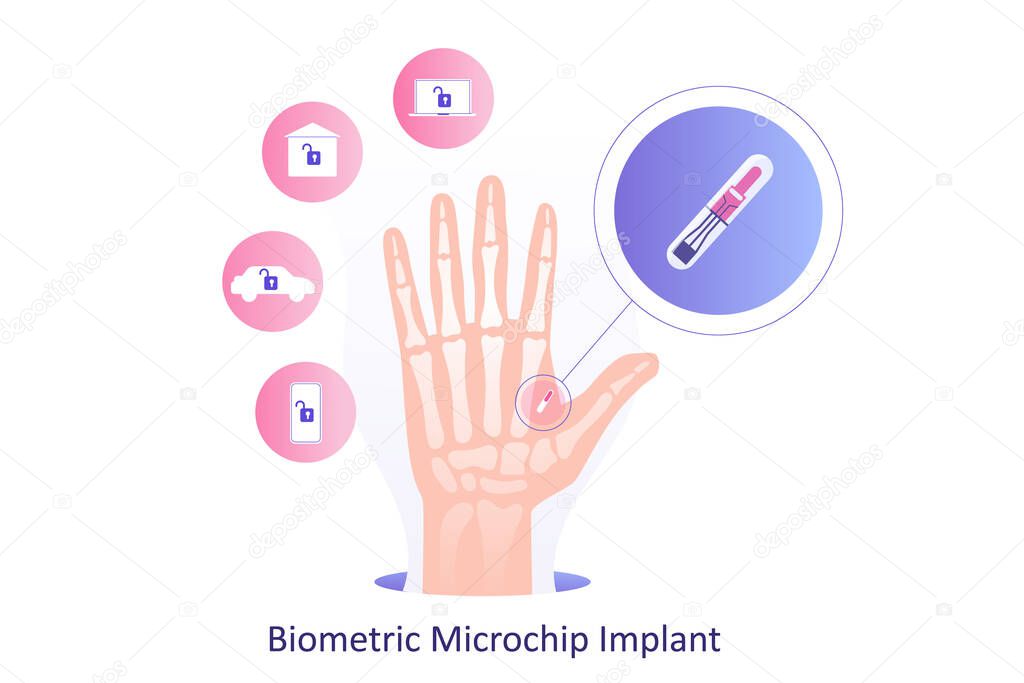 Implante biométrico de microchip para humanos. Microchip implantando