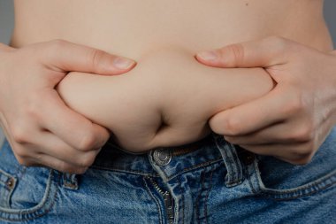 Genç bir kız karnında bir yağ katını tutuyor. Kilo kaybı, diyet kavramı.