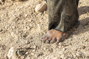 Kırsal kesimde yoksul insanların ayak