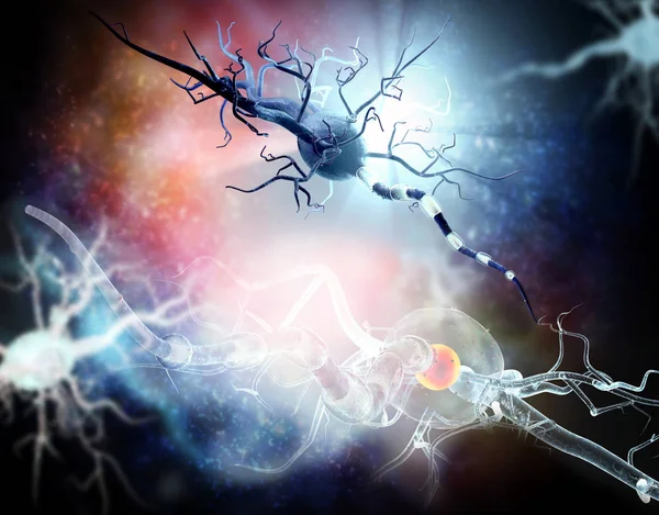 Cellule nervose danneggiate, concetto di malattia neurodegenerativa e neurologica, tumori, chirurgia cerebrale . — Foto Stock