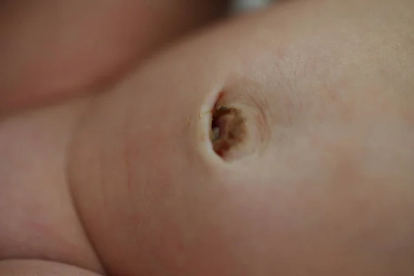 Navel van pasgeboren baby, close-up afbeelding — Stockfoto