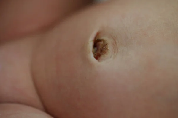 Umbigo do bebê recém-nascido, imagem close-up — Fotografia de Stock