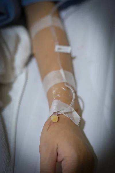 Iv Infusion intravenöse Injektion von Krankheitspatienten auf dem Bett liegend — Stockfoto