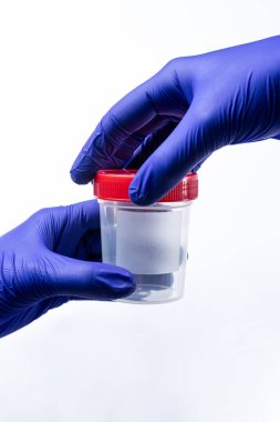 Doktor elinde bir kavanoz ya da idrar analizi için beyaz bir arkaplan tutuyor.