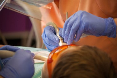 Dişlerini muayene eden bir uzmanı olan bir hastanın yakın çekimi. Yumuşak odaklanma. Kafadan görünüm.