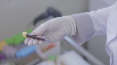 Kan analizi ve virüslü bir doktor.