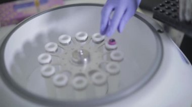 Kan analizi ve virüslü bir doktor.