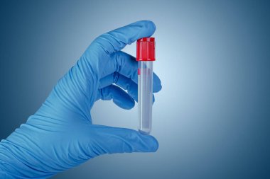 Araştırma laboratuarında elinde kan tüpü testi tutan teknisyen..