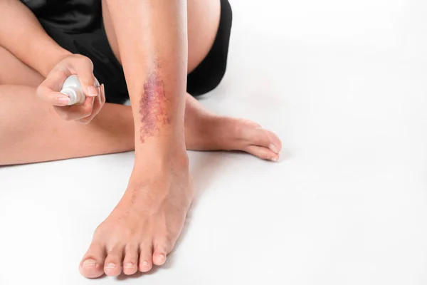 Asijské Ženy Mají Modřiny Noze Nehody Použití Medicíny Sprej Její — Stock fotografie