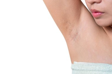 Asyalı kadınlar koltuk altını koltuk altı kıllarıyla gösteriyor. Beyaz arkaplanda izole et.