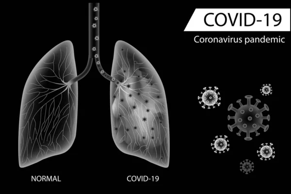 Humana Lungor Jämför Mellan Normal Skada Sidan Och Coronavirus Vektor — Stock vektor
