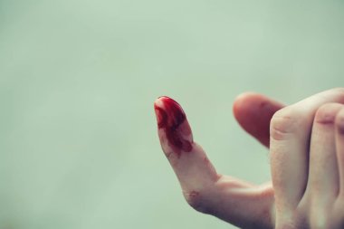 Kanlı insan parmağı