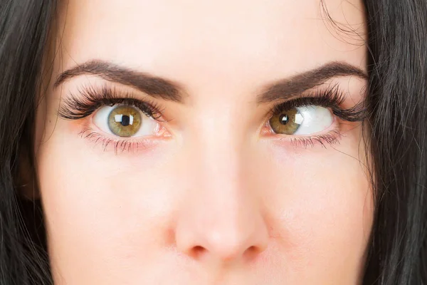 Galna kvinnliga ögon med skelning — Stockfoto