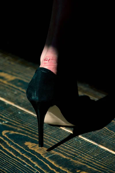 Frotar en la pierna en negro zapato de moda de mujer glamour —  Fotos de Stock