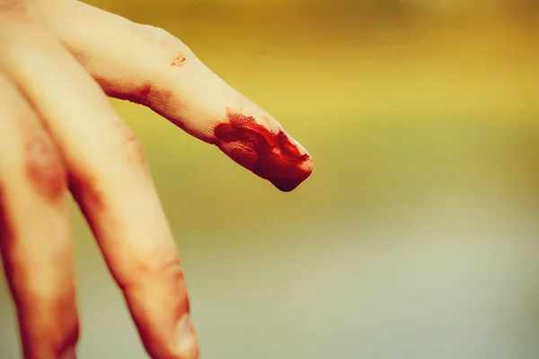Deget uman sângeros — Fotografie, imagine de stoc