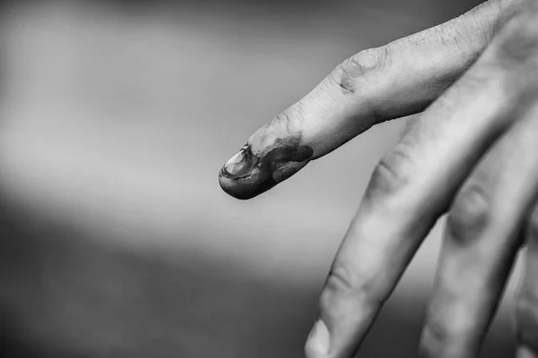 Bloedige menselijke vinger — Stockfoto
