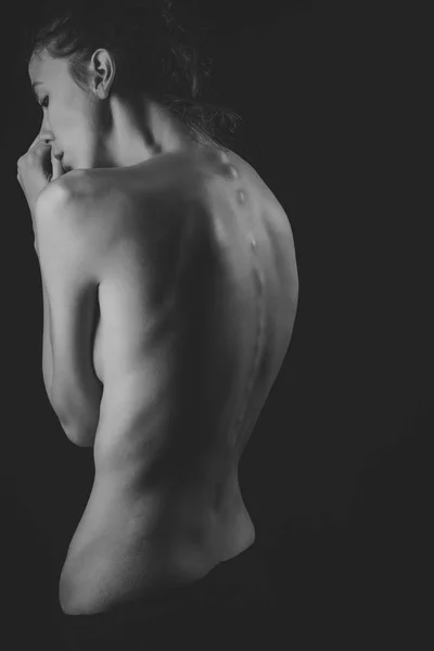 Woman with naked back silhouette. — Stock Photo, Image