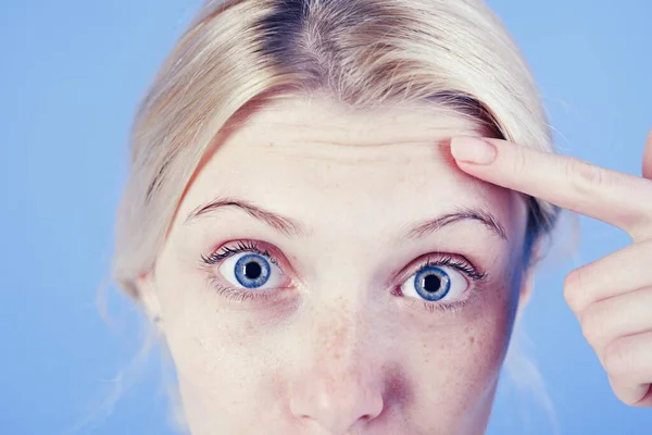 Las primeras arrugas. Mujer preguntándose por las arrugas en la frente. Concepto de cuidado de la piel. Crema de piel anti edad. Cosméticos y cirugía estética. Chica con arrugas en la frente de cerca. Signos de envejecimiento de la piel —  Fotos de Stock