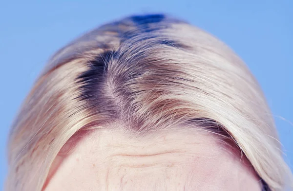 Κοντινό πλάνο καλλιεργούνται φυσικές ρίζες των έγχρωμων ξανθά μαλλιά. Λαμπερά και υγιή όμορφα μαλλιά. Υγιής και ευεξία έννοια. Φροντίδα μαλλιών ρουτίνα και μέτωπο με ρυτίδες. — Φωτογραφία Αρχείου