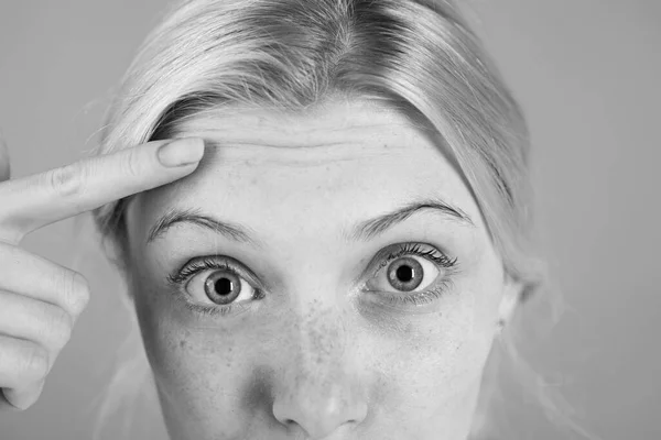 First wrinkles. Woman wondering face show wrinkles on forehead. Skin care concept. Anti age skin cream. Cosmetics and aesthetic surgery. Girl with wrinkles on forehead close up. Signs of skin aging — Stock Photo, Image