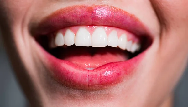 Denti sorridenti. Donna ridente bocca con grandi denti da vicino. Denti bianchi sani. Primo piano del sorriso con denti bianchi sani . — Foto Stock