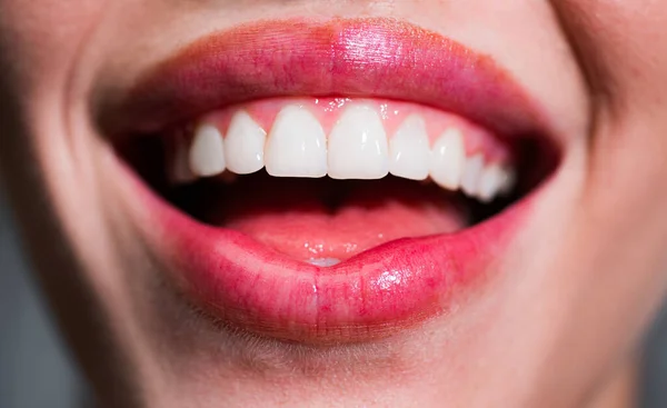 Улыбнись. Смеющийся женский рот с великолепными зубами закрывается. Здоровые белые зубы. Крупный план улыбки с белыми здоровыми зубами . — стоковое фото