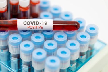 Test tüpleri rafını koronavirüs için pozitif kan örneğiyle kapat, kovid-19 virüsü. Coronavirus pozitif kan örneği tüpü.