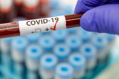 Test tüpleri rafını koronavirüs için pozitif kan örneğiyle kapat, kovid-19 virüsü. Coronavirus pozitif kan örneği tüpü.