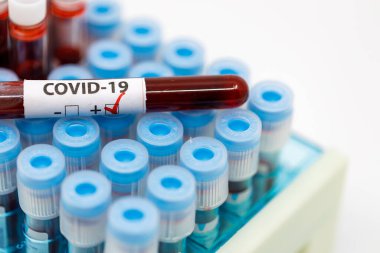 Test tüpleri rafını koronavirüs için pozitif kan örneğiyle kapat, kovid-19 virüsü. Coronavirus pozitif kan örneği tüpü.