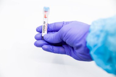 Kan testinin sonucuna göre hızla yayılan yeni Coronavirus için mavi eldivenli mikrobiyolog ya da tıp çalışanı eli yakından inceleniyor. COVID-19 Pozitif kavram