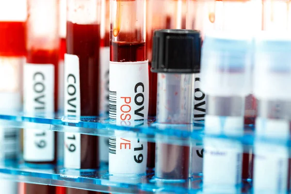 Close up of test tubes rack with positive blood sample for coronavirus, covid-19 virus. Coronavirus positive blood sample tube.