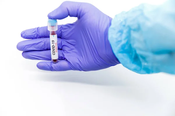 Closeup of microbiologist or medical worker hand with blue surgical gloves marking blood test result as positive for the new rapidly spreading Coronavirus. COVID-19 Positive concept