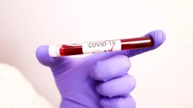 Coronavirus COVID19 için pozitif kan testi sonucu tutan ameliyat eldivenli doktor, mikrobiyolog ya da erkek hemşire elini kapatın. Kopyalama alanı olan beyaz arkaplan.